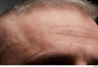  HD Face Skin Yury eyebrow face forehead skin pores skin texture wrinkles 0002.jpg